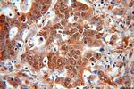 ENO1 Antibody in Immunohistochemistry (Paraffin) (IHC (P))