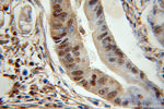 ENO1 Antibody in Immunohistochemistry (Paraffin) (IHC (P))