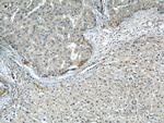 ENO1 Antibody in Immunohistochemistry (Paraffin) (IHC (P))