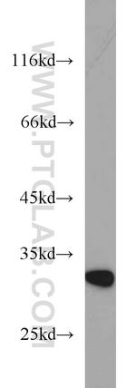 RSU1 Antibody in Western Blot (WB)