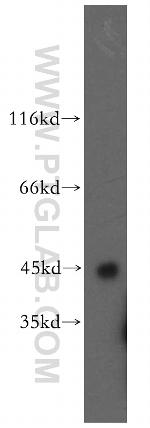 SPAM1 Antibody in Western Blot (WB)