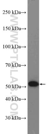 Pancreatic Lipase Antibody in Western Blot (WB)