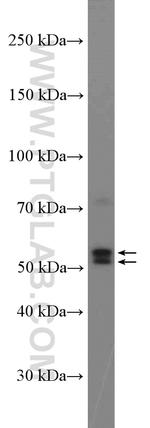 Pancreatic Lipase Antibody in Western Blot (WB)