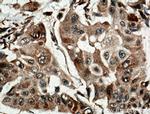 SUMF2 Antibody in Immunohistochemistry (Paraffin) (IHC (P))