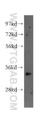 SUMF2 Antibody in Western Blot (WB)