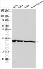 CCNL2 Antibody in Western Blot (WB)