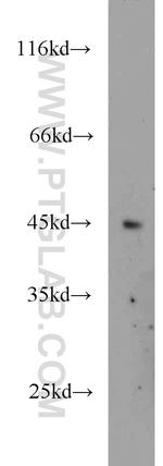 PTPN2 Antibody in Western Blot (WB)