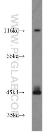 PTPN2 Antibody in Western Blot (WB)