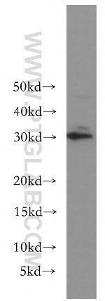 BIN3 Antibody in Western Blot (WB)