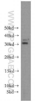 BIN3 Antibody in Western Blot (WB)
