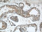 ZNF24 Antibody in Immunohistochemistry (Paraffin) (IHC (P))