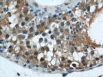 ZNF24 Antibody in Immunohistochemistry (Paraffin) (IHC (P))