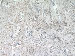 ZNF24 Antibody in Immunohistochemistry (Paraffin) (IHC (P))
