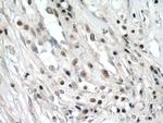 ZNF24 Antibody in Immunohistochemistry (Paraffin) (IHC (P))