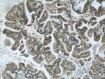 ZNF24 Antibody in Immunohistochemistry (Paraffin) (IHC (P))