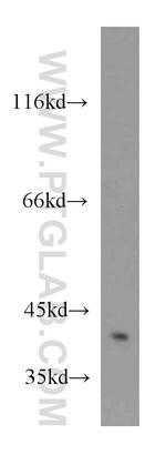 ZNF24 Antibody in Western Blot (WB)