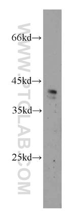 ZNF24 Antibody in Western Blot (WB)