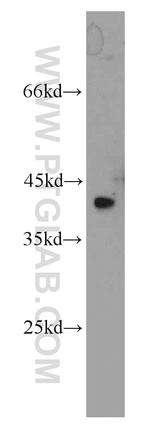 ZNF24 Antibody in Western Blot (WB)