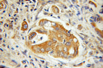 ILVBL Antibody in Immunohistochemistry (Paraffin) (IHC (P))