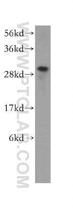 HUS1 Antibody in Western Blot (WB)