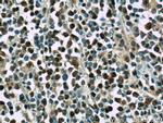 MCM7 Antibody in Immunohistochemistry (Paraffin) (IHC (P))