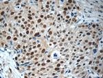 MCM7 Antibody in Immunohistochemistry (Paraffin) (IHC (P))