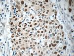 MCM7 Antibody in Immunohistochemistry (Paraffin) (IHC (P))