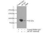 MCM7 Antibody in Immunoprecipitation (IP)