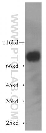 MCM7 Antibody in Western Blot (WB)