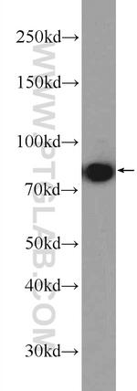 MCM7 Antibody in Western Blot (WB)