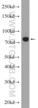 MCM7 Antibody in Western Blot (WB)