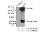 MAP4 Antibody in Immunoprecipitation (IP)