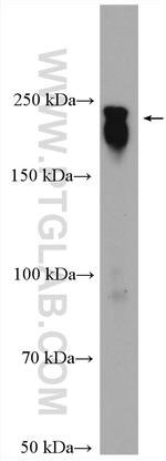 MAP4 Antibody in Western Blot (WB)