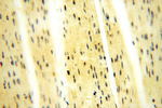 Casein Kinase 1 epsilon Antibody in Immunohistochemistry (Paraffin) (IHC (P))