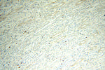 Casein Kinase 1 epsilon Antibody in Immunohistochemistry (Paraffin) (IHC (P))