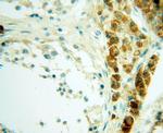 Casein Kinase 1 epsilon Antibody in Immunohistochemistry (Paraffin) (IHC (P))