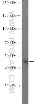 Casein Kinase 1 epsilon Antibody in Western Blot (WB)