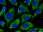 EIF2A Antibody in Immunocytochemistry (ICC/IF)