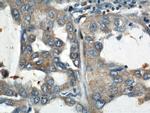 RHOT2 Antibody in Immunohistochemistry (Paraffin) (IHC (P))