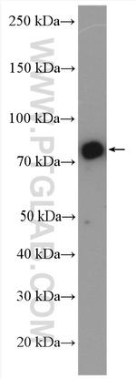 RHOT2 Antibody in Western Blot (WB)