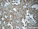 Cathepsin K Antibody in Immunohistochemistry (Paraffin) (IHC (P))