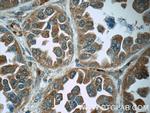 Cathepsin K Antibody in Immunohistochemistry (Paraffin) (IHC (P))