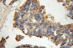 Cathepsin K Antibody in Immunohistochemistry (Paraffin) (IHC (P))