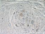 Cathepsin K Antibody in Immunohistochemistry (Paraffin) (IHC (P))