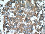 Cathepsin K Antibody in Immunohistochemistry (Paraffin) (IHC (P))