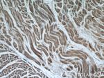 EDEM2 Antibody in Immunohistochemistry (Paraffin) (IHC (P))