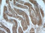 EDEM2 Antibody in Immunohistochemistry (Paraffin) (IHC (P))