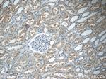 ARHGEF18 Antibody in Immunohistochemistry (Paraffin) (IHC (P))