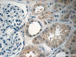 ARHGEF18 Antibody in Immunohistochemistry (Paraffin) (IHC (P))