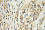 ARHGEF18 Antibody in Immunohistochemistry (Paraffin) (IHC (P))